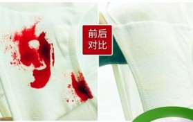 内裤血渍清洗小妙招（内裤血渍清除方式）