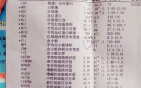 血小板低的原因？血小板低是什么原因引起的？