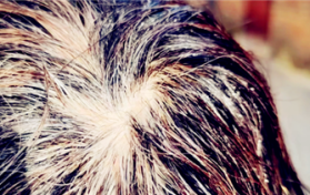 魔术丝能让秃顶的再次长出来吗图3